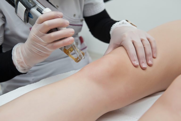 Laser Hair Removal in Manchester