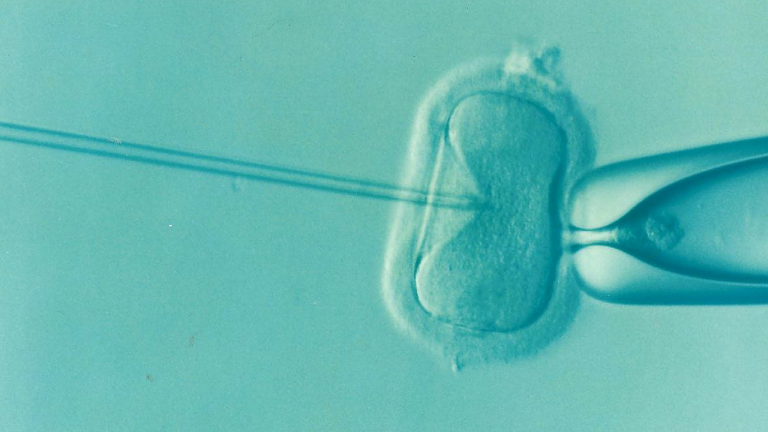 What are common causes of infertility?