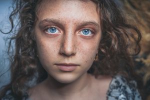 Which Vitamin Deficiency Causes Small White Spots on Skin?
